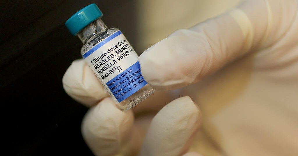 Trump's call to split up the MMR vaccine revives long-settled debate