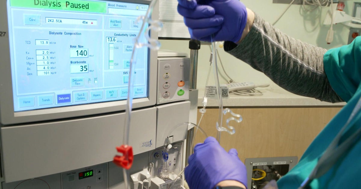 Lawmaker asks what happened to probe into for-profit dialysis industry