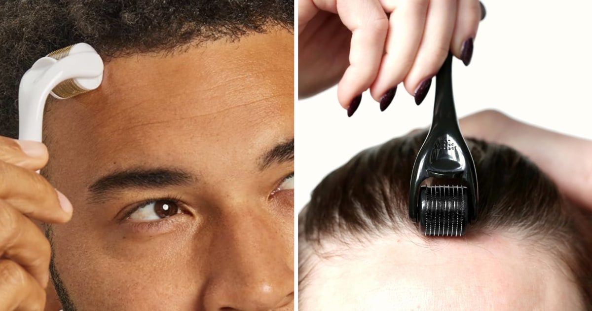 Yes, rolling hundreds of tiny needles over your scalp can help with hair growth — here’s how to dermaroll the right way, according to experts