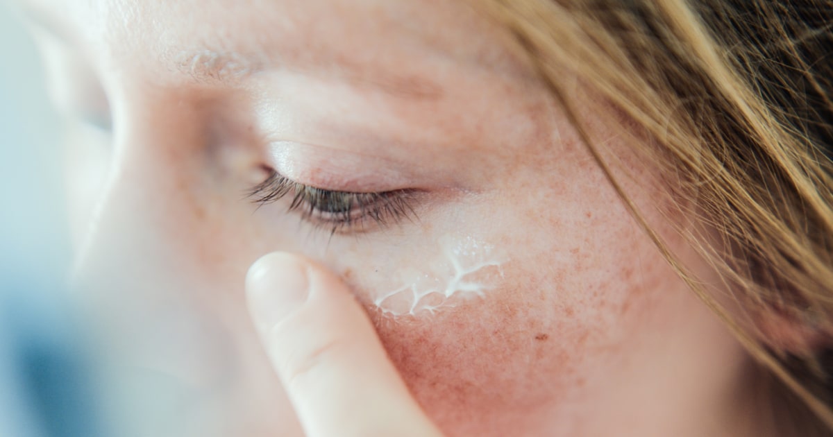 Those tiny white bumps aren’t pimples, they’re milia — here’s how to get rid of them